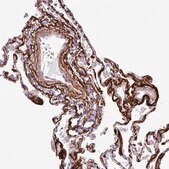 Anti-COL8A1 antibody produced in rabbit Prestige Antibodies&#174; Powered by Atlas Antibodies, affinity isolated antibody, buffered aqueous glycerol solution