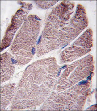 ANTI-PTPD1 (CENTER) antibody produced in rabbit IgG fraction of antiserum, buffered aqueous solution