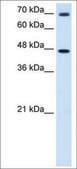 Anti-GABRP antibody produced in rabbit affinity isolated antibody