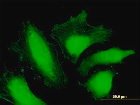 Anti-MTMR15 antibody produced in mouse IgG fraction of antiserum, buffered aqueous solution