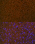 Anti-Coagulation Protein C Antibody, clone 3W3R7, Rabbit Monoclonal