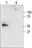 Anti-Potassium Channel K2P4.1 (TRAAK) 兔抗 affinity isolated antibody, lyophilized powder