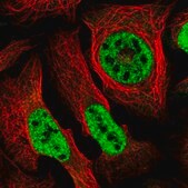 Anti-SEPHS2 antibody produced in rabbit Prestige Antibodies&#174; Powered by Atlas Antibodies, affinity isolated antibody, buffered aqueous glycerol solution