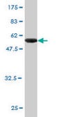 Monoclonal Anti-CLIC1 antibody produced in mouse clone 2D4, purified immunoglobulin, buffered aqueous solution
