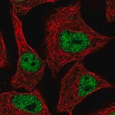 Anti-ZNF574 antibody produced in rabbit Prestige Antibodies&#174; Powered by Atlas Antibodies, affinity isolated antibody, buffered aqueous glycerol solution