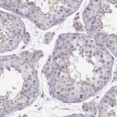 Anti-OXT antibody produced in rabbit Prestige Antibodies&#174; Powered by Atlas Antibodies, affinity isolated antibody