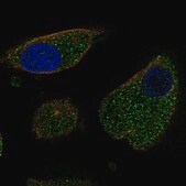 Anti-LURAP1 antibody produced in rabbit Prestige Antibodies® Powered by Atlas Antibodies, affinity isolated antibody, buffered aqueous glycerol solution, ab2