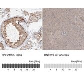 Anti-RNF219 antibody produced in rabbit Prestige Antibodies® Powered by Atlas Antibodies, affinity isolated antibody, buffered aqueous glycerol solution