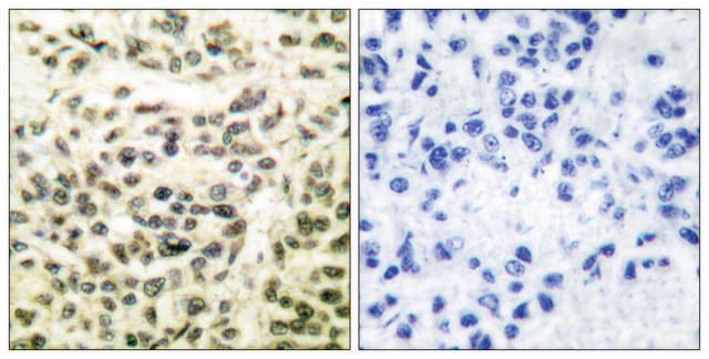Anti-GSK3 antibody produced in rabbit affinity isolated antibody