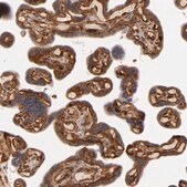 Anti-LAMC1 antibody produced in rabbit Ab1, Prestige Antibodies&#174; Powered by Atlas Antibodies, affinity isolated antibody, buffered aqueous glycerol solution