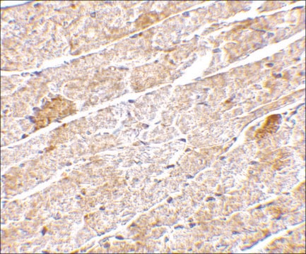 Anti-Neuritin antibody produced in rabbit affinity isolated antibody, buffered aqueous solution