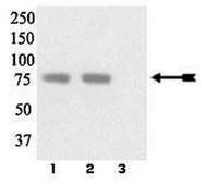 Anti-phospho-LIMK 1/2 (Tyr507/Thr508) Antibody Upstate®, from rabbit