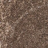 Anti-RNF113A antibody produced in rabbit Prestige Antibodies&#174; Powered by Atlas Antibodies, affinity isolated antibody, buffered aqueous glycerol solution