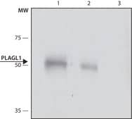 Anti-PLAGL1 (C-terminal) antibody produced in rabbit ~1.0 mg/mL, affinity isolated antibody, buffered aqueous solution