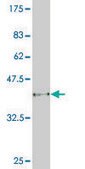 Monoclonal Anti-MUSK antibody produced in mouse clone 2H6, purified immunoglobulin, buffered aqueous solution