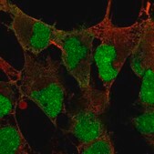 Anti-DPPA4 antibody produced in rabbit Prestige Antibodies&#174; Powered by Atlas Antibodies, affinity isolated antibody, buffered aqueous glycerol solution