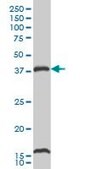 Monoclonal Anti-CAMK1, (C-terminal) antibody produced in mouse clone 2B6, purified immunoglobulin, buffered aqueous solution
