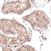 Anti-BTBD7 antibody produced in rabbit Prestige Antibodies&#174; Powered by Atlas Antibodies, affinity isolated antibody, buffered aqueous glycerol solution
