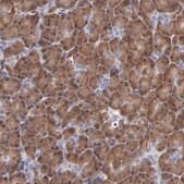 Anti-ZNF155 antibody produced in rabbit Prestige Antibodies® Powered by Atlas Antibodies, affinity isolated antibody, buffered aqueous glycerol solution