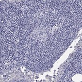 Anti-CDHR3 antibody produced in rabbit Prestige Antibodies&#174; Powered by Atlas Antibodies, affinity isolated antibody, buffered aqueous glycerol solution