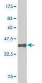Monoclonal Anti-SETDB1 antibody produced in mouse clone 4A3, purified immunoglobulin, buffered aqueous solution
