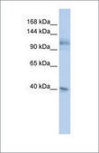 Anti-MSH2 antibody produced in rabbit affinity isolated antibody