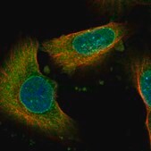 Anti-NAV3 antibody produced in rabbit Prestige Antibodies&#174; Powered by Atlas Antibodies, affinity isolated antibody, buffered aqueous glycerol solution