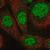Anti-ZNF180 antibody produced in rabbit Prestige Antibodies&#174; Powered by Atlas Antibodies, affinity isolated antibody, buffered aqueous glycerol solution, ab2