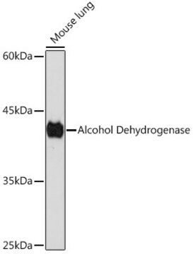 Anti-Alcohol Dehydrogenase Antibody, clone 1X3C0, Rabbit Monoclonal