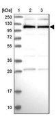 Anti-CACTIN antibody produced in rabbit Prestige Antibodies® Powered by Atlas Antibodies, affinity isolated antibody, buffered aqueous glycerol solution