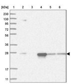 Anti-PSMA5 antibody produced in rabbit Prestige Antibodies&#174; Powered by Atlas Antibodies, affinity isolated antibody, buffered aqueous glycerol solution, ab3