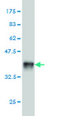 Monoclonal Anti-FTCD antibody produced in mouse clone 3A4, purified immunoglobulin, buffered aqueous solution