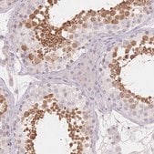 抗-SUV39H2 兔抗 Prestige Antibodies&#174; Powered by Atlas Antibodies, affinity isolated antibody, buffered aqueous glycerol solution