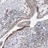 Anti-LTN1 antibody produced in rabbit Prestige Antibodies® Powered by Atlas Antibodies, affinity isolated antibody, buffered aqueous glycerol solution