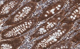 Anti-γ Catenin Antibody, clone 1H22 ZooMAb® Rabbit Monoclonal recombinant, expressed in HEK 293 cells