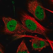 Anti-MON2 antibody produced in rabbit Prestige Antibodies&#174; Powered by Atlas Antibodies, affinity isolated antibody, buffered aqueous glycerol solution