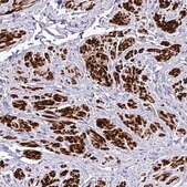 Anti-RIPPLY1 antibody produced in rabbit Prestige Antibodies&#174; Powered by Atlas Antibodies, affinity isolated antibody, buffered aqueous glycerol solution