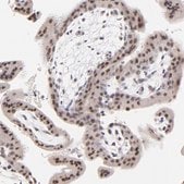 Anti-ZNF177 antibody produced in rabbit Prestige Antibodies&#174; Powered by Atlas Antibodies, affinity isolated antibody, buffered aqueous glycerol solution