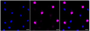 Anti-phospho-beta Catenin (Thr41/Ser45) Antibody, clone 23GB3875, Rabbit Monoclonal clone 23GB3875, recombinant rabbit monoclonal, expressed in HEK293 cells