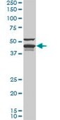 Monoclonal Anti-DNAJA4 antibody produced in mouse clone 4B4-1F2, purified immunoglobulin, buffered aqueous solution