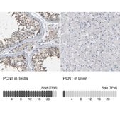 Anti-PCNT antibody produced in rabbit Prestige Antibodies® Powered by Atlas Antibodies, affinity isolated antibody, buffered aqueous glycerol solution, Ab2