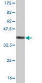 Monoclonal Anti-RPS23 antibody produced in mouse clone 1E3, purified immunoglobulin, buffered aqueous solution