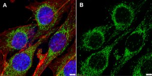 Anti-PRDX3 Antibody, clone 2I14 ZooMAb® Rabbit Monoclonal recombinant, expressed in HEK 293 cells