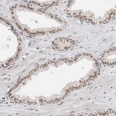 Anti-NCAPG2 antibody produced in rabbit Prestige Antibodies&#174; Powered by Atlas Antibodies, affinity isolated antibody, buffered aqueous glycerol solution