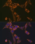 Anti-Galectin 1/LGALS1 antibody produced in rabbit