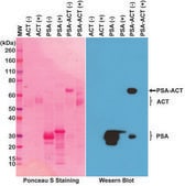 Anti-PSA (Prostate Specific Antigen) antibody, Rabbit monoclonal recombinant, expressed in HEK 293 cells, clone RM323, purified immunoglobulin