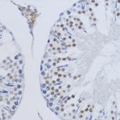 Anti-DiMethyl-Histone H3-K79 antibody produced in rabbit