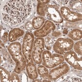 Anti-RABIF antibody produced in rabbit Prestige Antibodies&#174; Powered by Atlas Antibodies, affinity isolated antibody, buffered aqueous glycerol solution