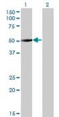 Monoclonal Anti-ZNF213 antibody produced in mouse clone 5D7, purified immunoglobulin, buffered aqueous solution
