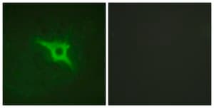 Anti-p47 PHOX antibody produced in rabbit affinity isolated antibody